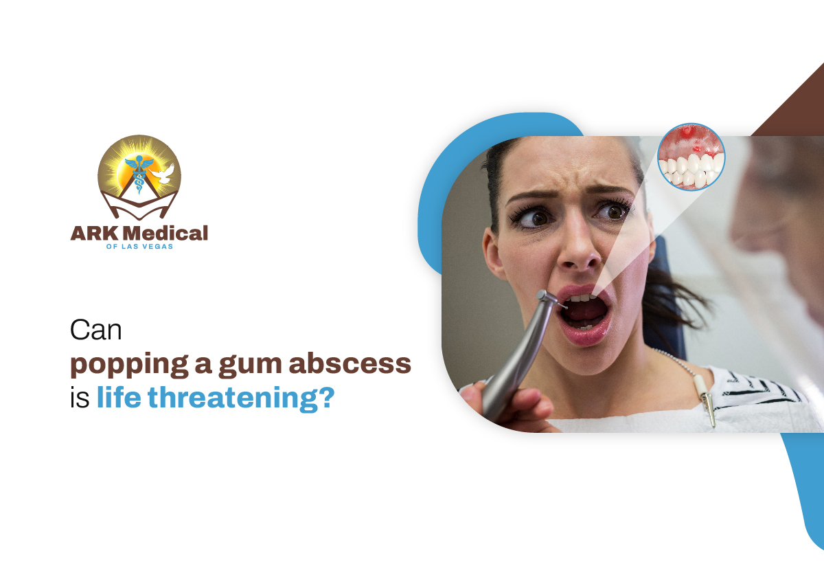 Can Popping a Gum Abscess Be Life-Threatening