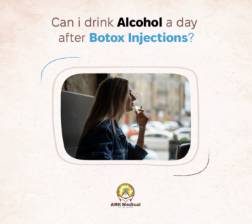 Can I Drink Alcohol a Day After Botox Injections