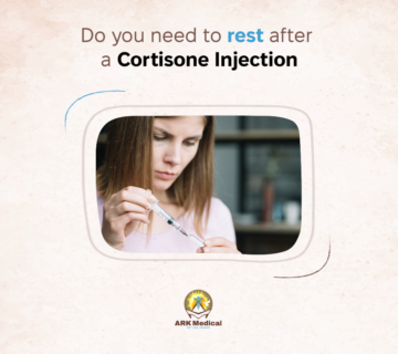 Do You Need to Rest After a Cortisone Injection