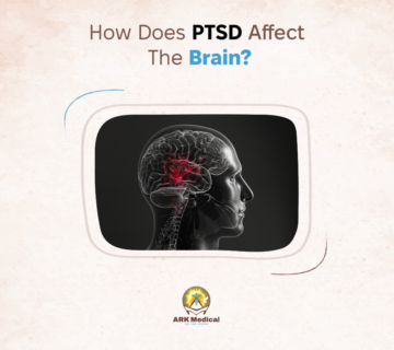 How Does PTSD Affect the Brain