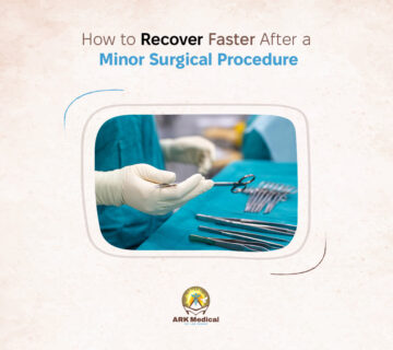 How to Recover Faster After a Minor Surgical Procedure