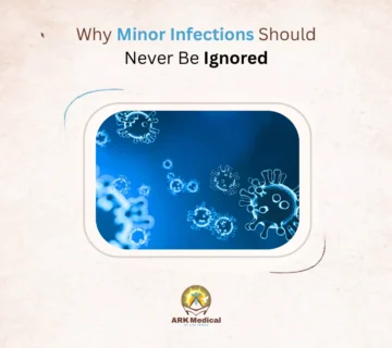 Why Minor Infections Should Never Be Ignored